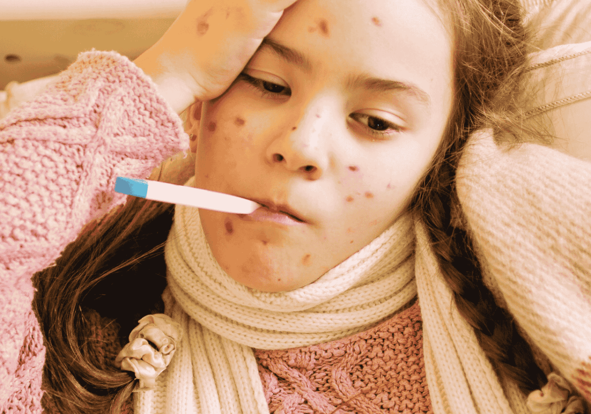 vacuna del sarampión