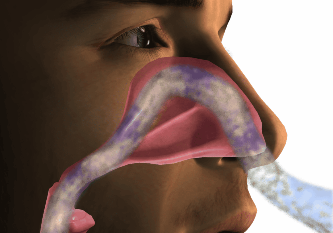 perforación septal