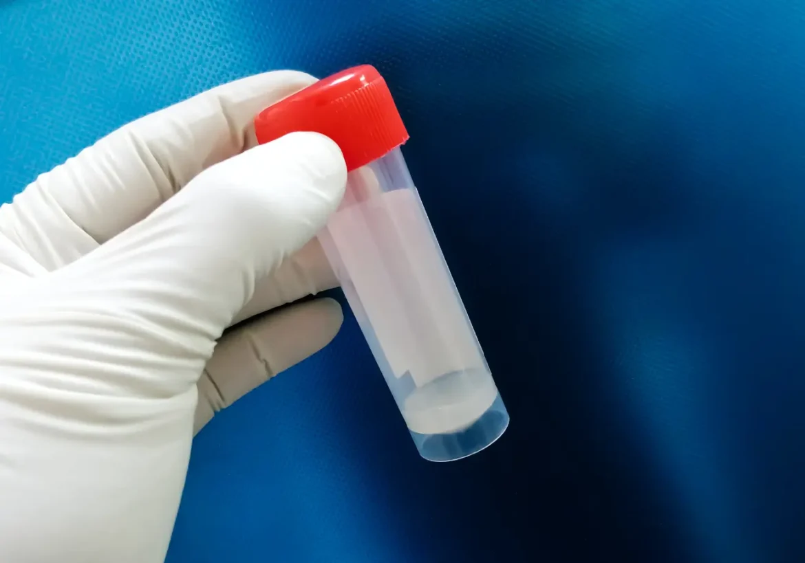 calidad del semen